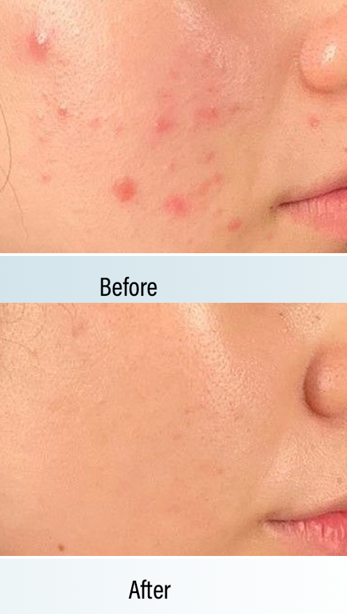 Shopylife LED Rejuvenator Shopylife