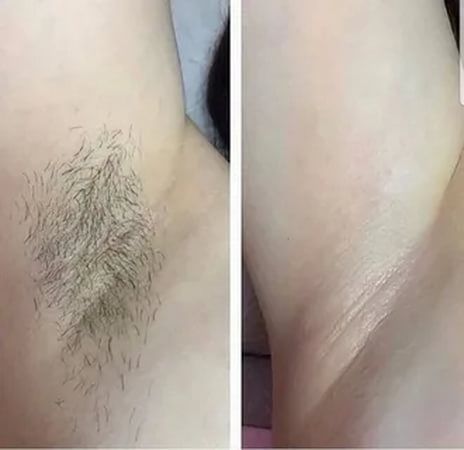 Luma Skin Pro Shopylife