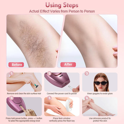 Depilador Laser Permanente Shopylife