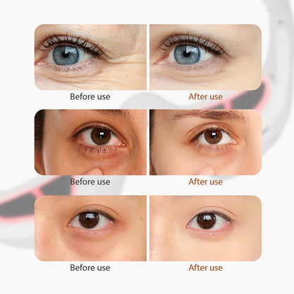 Rejuven Eyes Aura™ + Free gift (Facial massage roller + Alignment band V + Roller massager Y + Anti-acne tape)